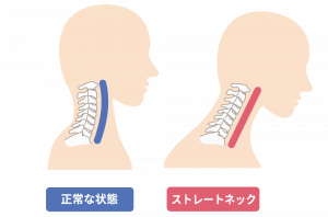 Thumbnail of post image 017